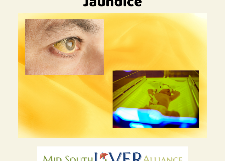 Graphic of a yellow background with a photo of a jaundiced eye and a newborn under a warming light