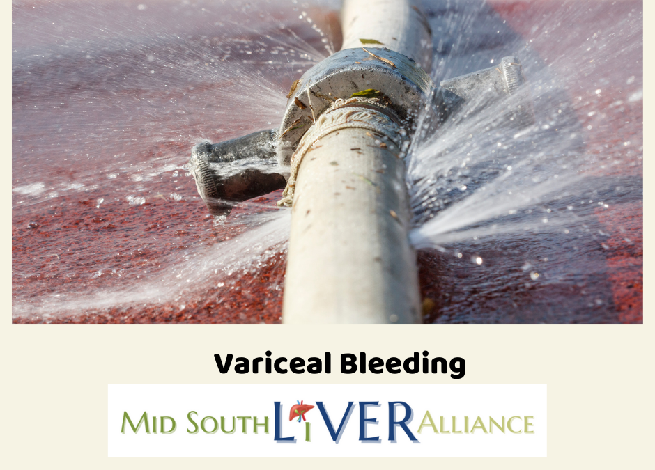 Photo of a burst water pipe, the words Variceal Bleeding and the logo for Mid South Liver Alliance